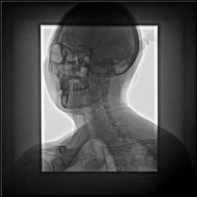 PLX8500 Series Multifunctional Dynamic Digital radiography - Image 3