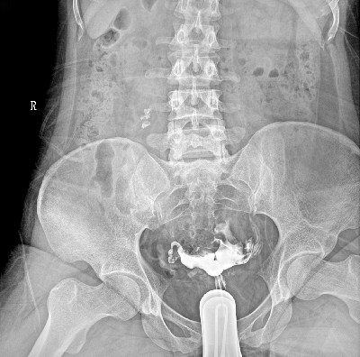 PLX8500 Series Multifunctional Dynamic Digital radiography - Image 4