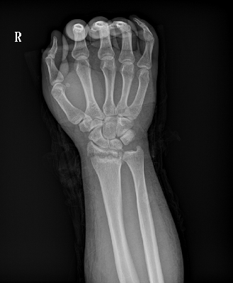 PLX8500 Series Multifunctional Dynamic Digital radiography - Image 5